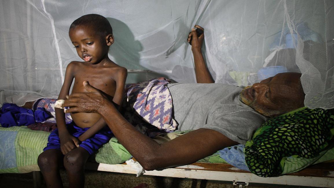 مرض وجوع في الصومال 