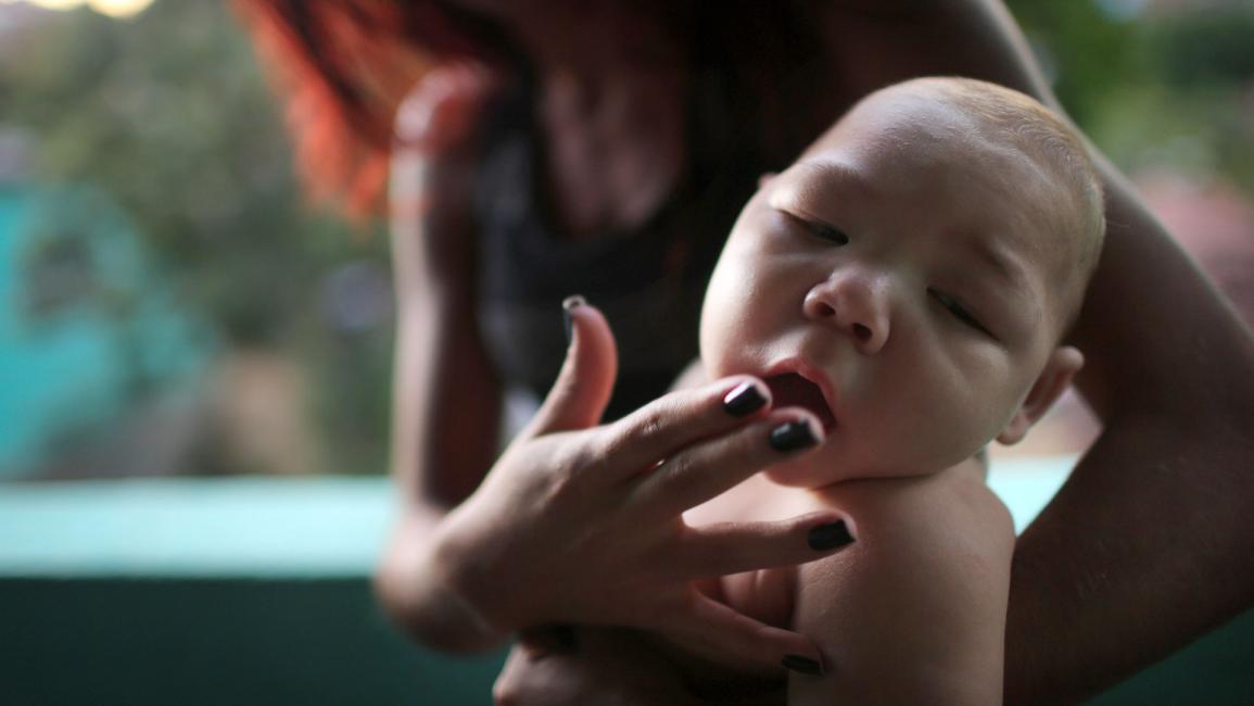 رؤوس صغيرة..فيروس زيكا يهاجم أطفال البرازيل