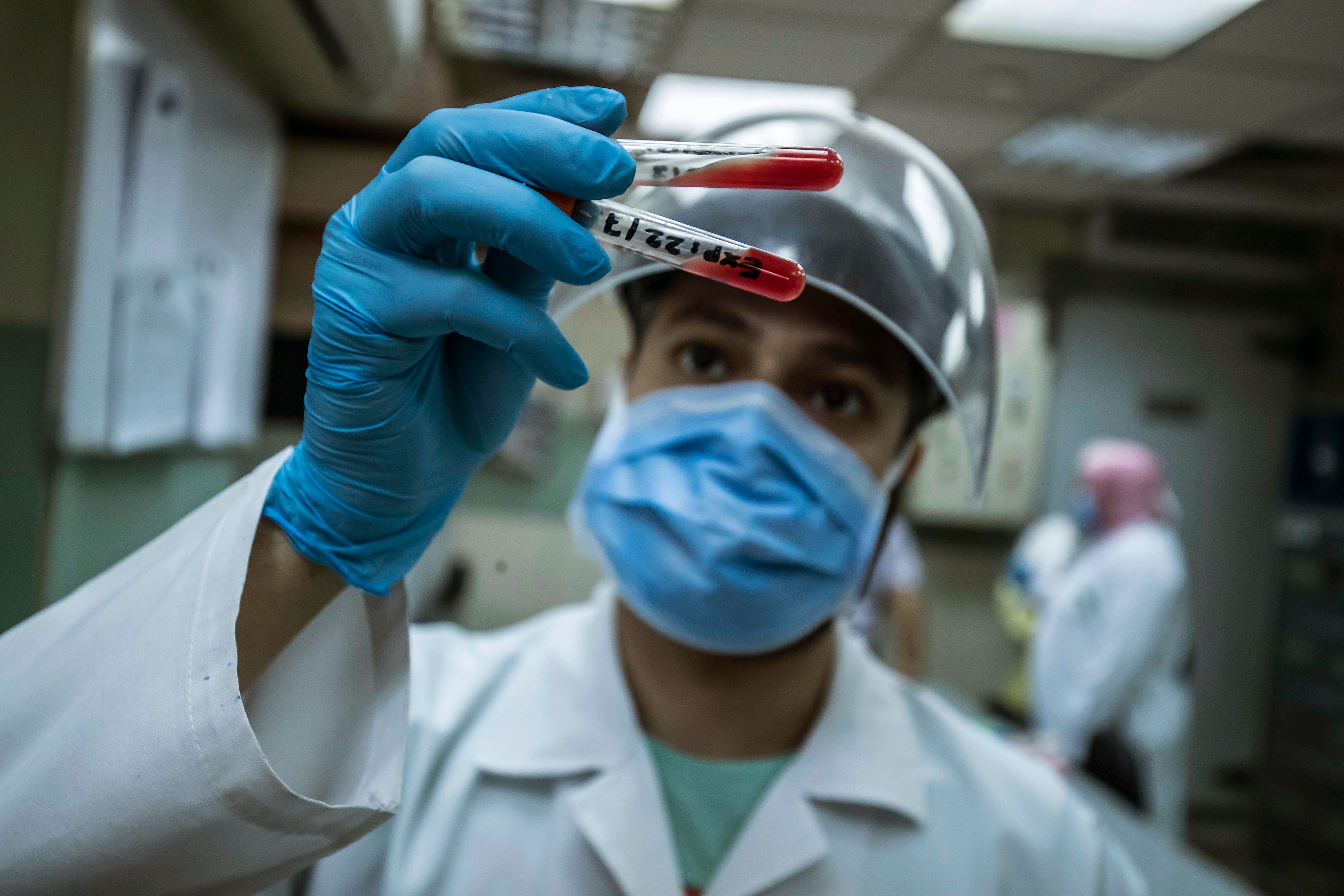 لا ترخيص حتى الآن للقاح "سينوفاك" المصري (خالد دسوقي/ فرانس برس)