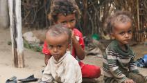 سوء التغذية أحد أخطر الأزمات الصحية في اليمن (هيومن أبيل)