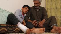 فتى أصيب بانفجار لغم في إدلب (مصطفى بطيش/ الأناضول)