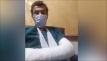 أصيب الطبيب الشاب بكسر في الساعد الأيمن نتيجة الاعتداء عليه (فيسبوك)