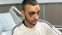 أصيب خالد بكسر في الجمجمة على يد قوات الاحتلال الإسرائيلي (العربي الجديد)