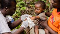 طفل مصاب بجدري القردة في جمهورية أفريقيا الوسطى (شارلز بوسيل/ فرانس برس)