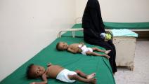 أسر اليمن بلا حيلة أمام سوء التغذية الحاد (خالد زياد/ فرانس برس)