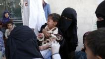 تضاعفت حالات الحصبة لدى أطفال اليمن خلال عام (محمد حمود/ الأناضول)