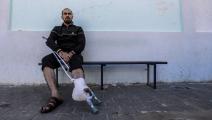 وضع شبه مستحيل للمصابين ومبتوري الأطراف في غزة (أحمد حسب الله/ Getty)