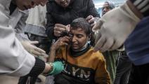 طفل جريح يعالج في أحد مستشفيات غزة (علي جاد الله/ الأناضول)