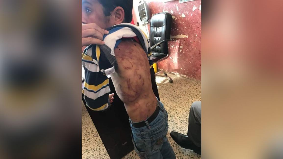 تعذيب طفل عراقي