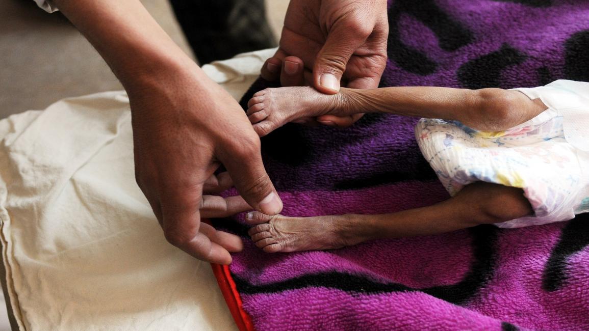 سوء التغذية في اليمن