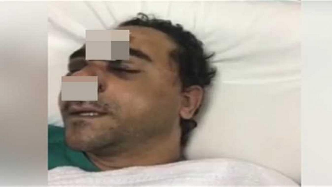 الاعتداء على عامل مصري بالكويت