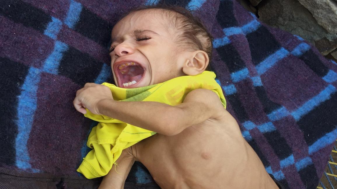المجاعة في اليمن (سودارسان راغافان/Getty)