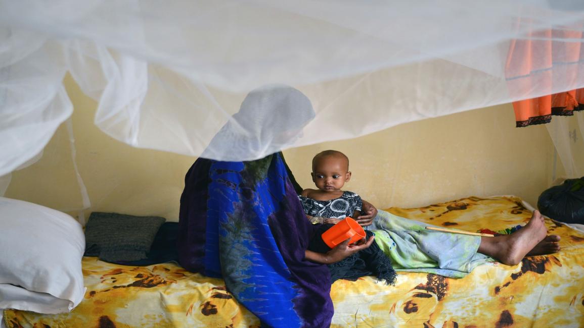 طفل يمني يعاني من سوء تغذية/مجتمع/7-5-2017 (طوني كارومبا/فرانس برس)