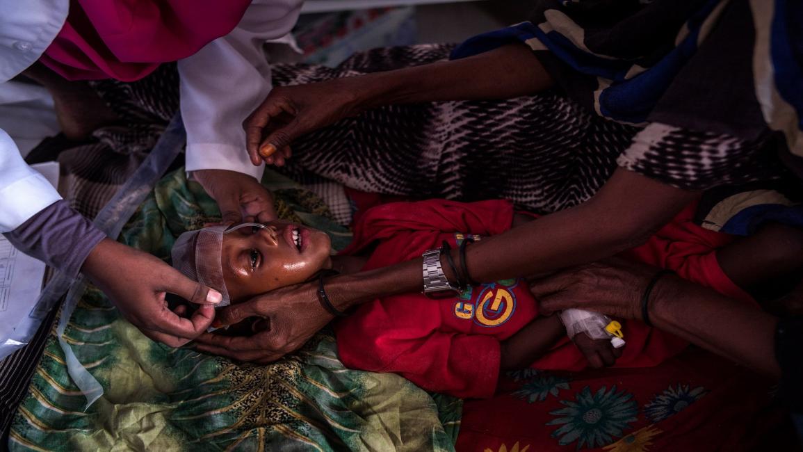 مجاعة في الصومال/مجتمع/17-3-2017 (أندرو رينيسين/ Getty)