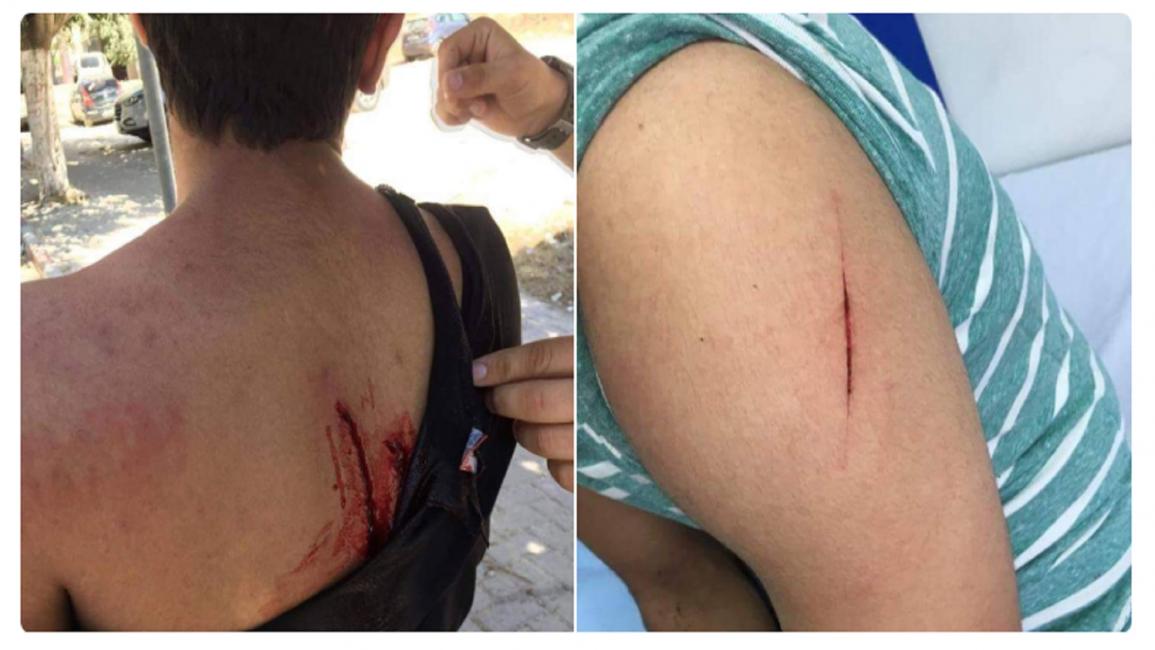 إصابات طلاب جامعة النجاح الفلسطينية خلال شجار (تويتر)