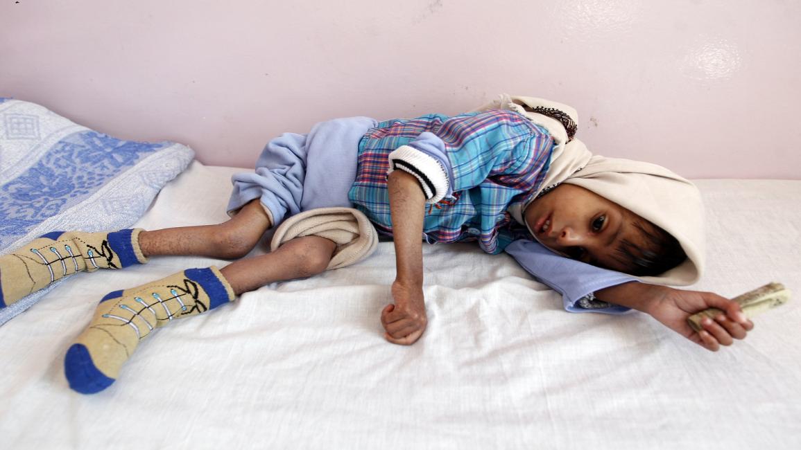 مجاعة في اليمن/مجتمع/2-11-2016 (محمد حويس/ فرانس برس)