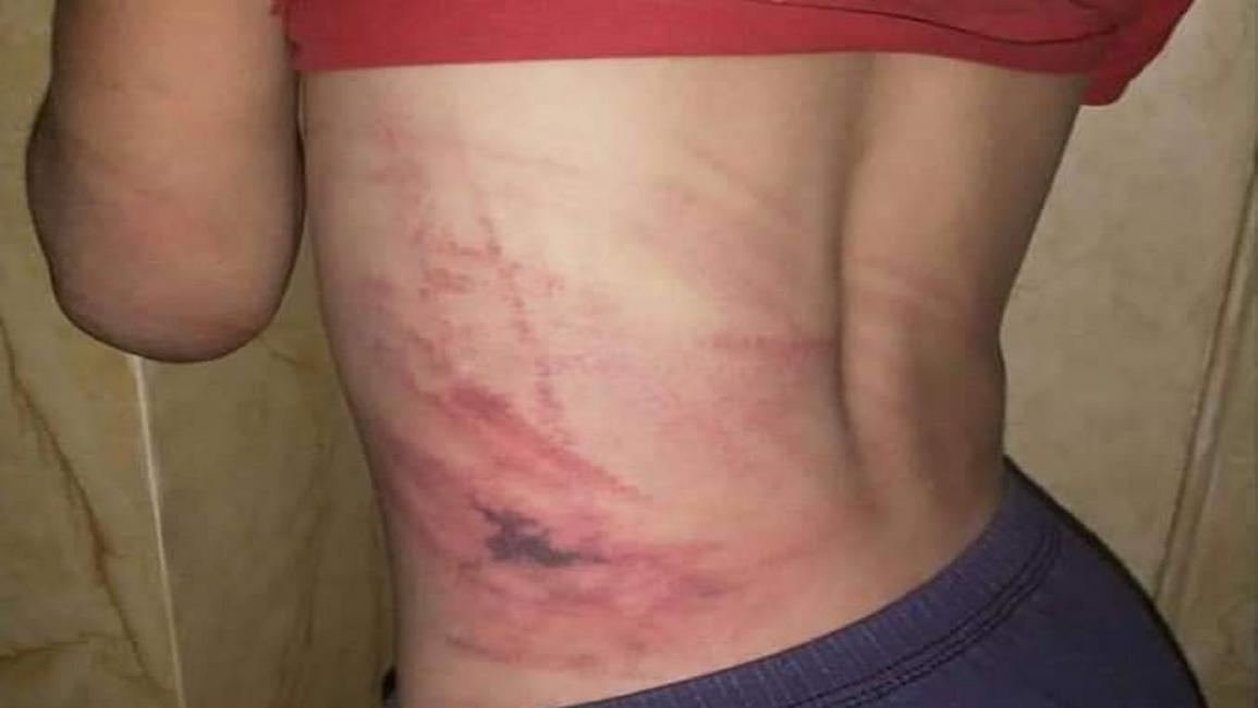 اعتداء على طفل سوري في مدينة التل (فيسبوك)