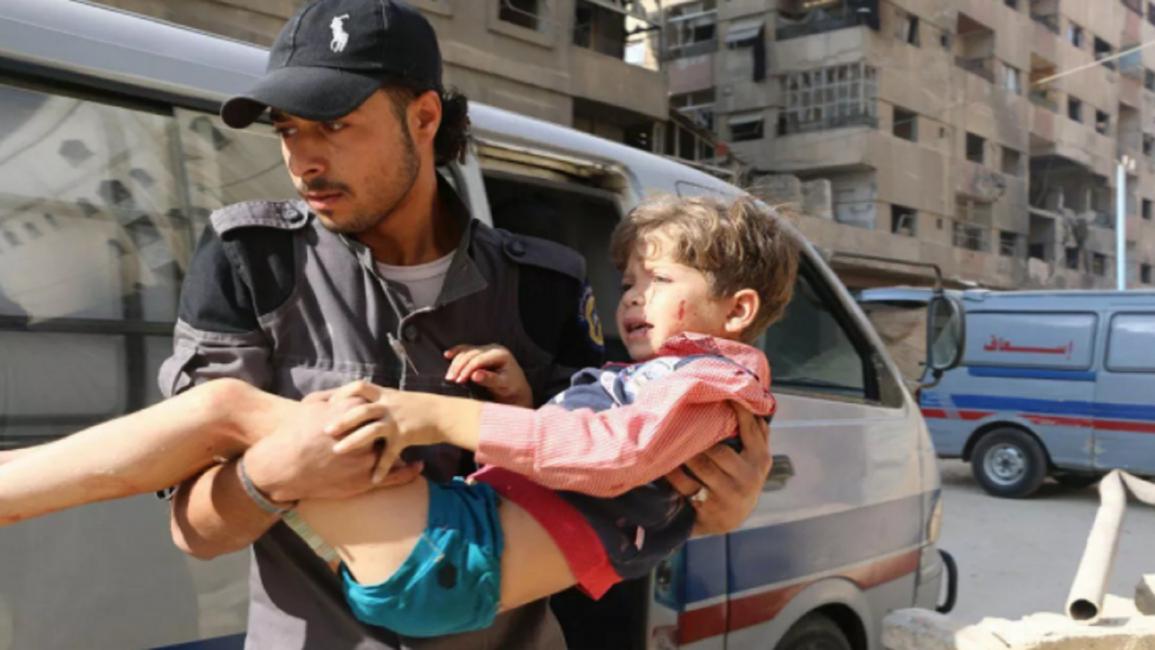 طفل سوري أصيب بقصف على قرية مسرابا (الشبكة السورية)