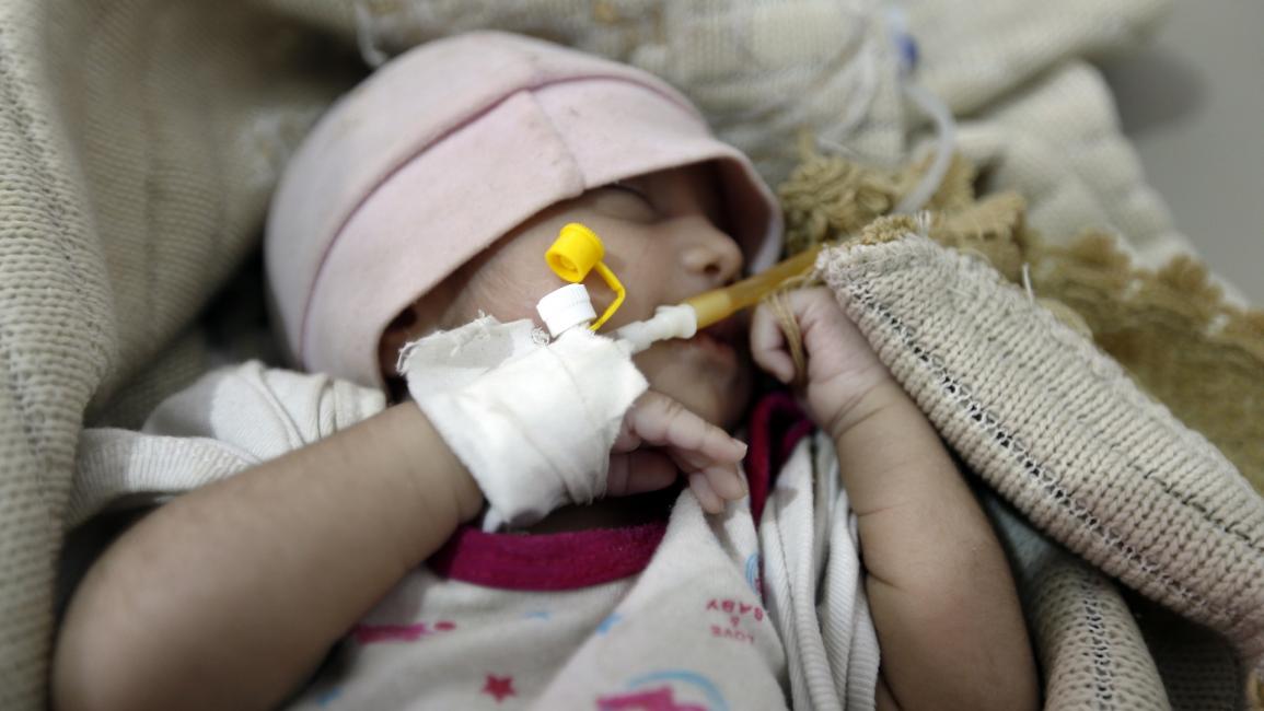 طفلة يمنية يشتبه في إصابتها بالكوليرا - اليمن -مجتمع