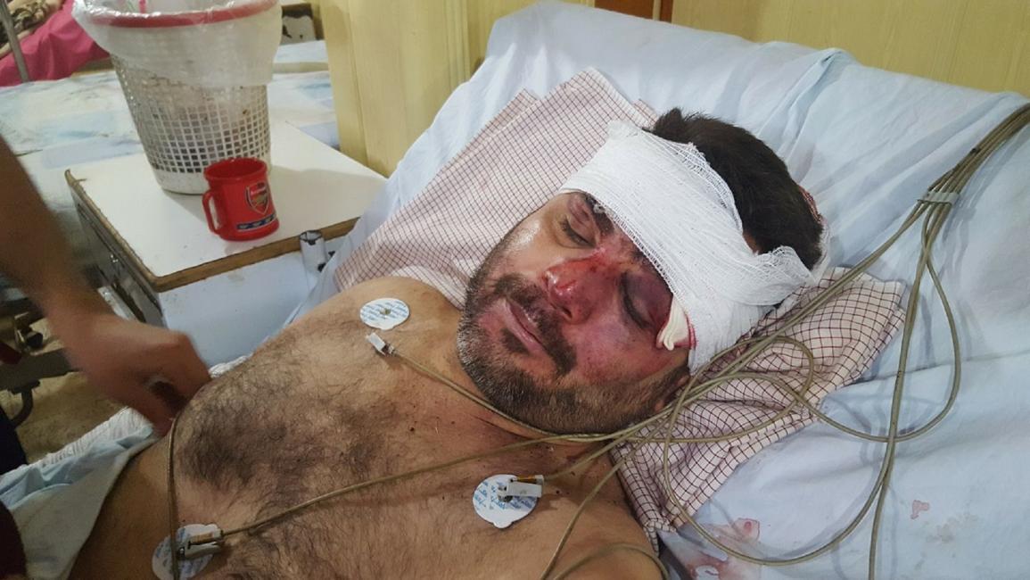 اعتداء على الطبيب السوري نعمان الفوال في دوما (فيسبوك)