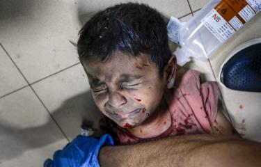 طفل جريح جراء قصف إسرائيلي على دير البلح وسط قطاع غزة 4/6/2024 (أشرف أبو عمرة/الأناضول)