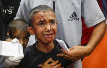 طفل جريح في وسط قطاع غزة جراء غارات إسرائيلية، 4 يونيو 2024 (Getty)