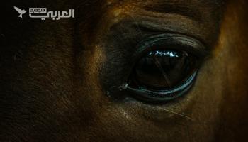 "الحصان الحزين" مرض نادر وقاتل، ماذا تعرف عنه؟