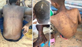  أطفال تعرضوا للتعذيب في مخزن للمهربين بمنطقة تازربو جنوب شرقي ليبيا 