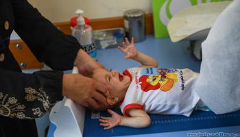  أطفال غزة وسوء التغذية (عبد الحكيم أبو رياش)
