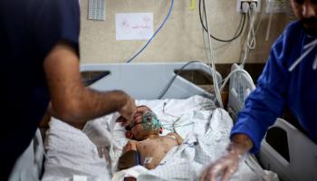 طفل مصاب في مستشفى في غزة (أحمد حسب الله/ Getty)