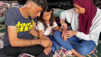 أب غزي يستخدم الأساور الملونة للتعرف على عائلته بحال تعرضهم للقصف