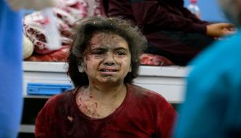 طفلة فلسطينية مصابة داخل مستشفى الشفاء في غزّة في 5/ 11/ 2023 (فرانس برس)