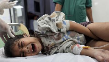 طفلة جريحة في مستشفى في غزة (محمد عابد/ فرانس برس)
