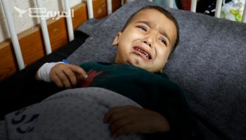 الطفل الفلسطيني أحمد شبات.. قصف الاحتلال أفقده والديه وشقيقه وقدميه 