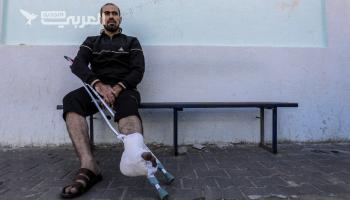 بتر الأطراف خيار مؤلم لآلاف الجرحى في غزة بدلاً من الموت