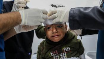 معالجة طفل فلسطيني مصاب في رفح في غزة (أحمد حسب الله/ Getty)