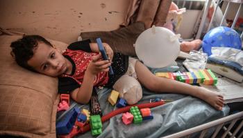 مئات الأطفال فقدوا أطرافهم خلال العدوان على غزة (عبد زقوت/الأناضول)