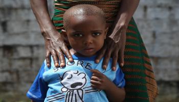 طفل ناج من إيبولا في ليبيريا