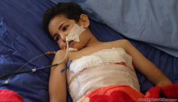 العراق: وفاة طفل بسبب ضربه من زوجة أبيه