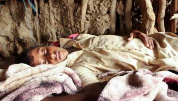 طفل مصاب بحمى الضنك في اليمن/مجتمع (عيسى أحمد/ الأناضول)