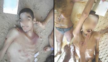 صور التعذيب في سورية