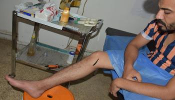 أثناء علاج أحد العراقيين بدودة العلق (العربي الجديد)