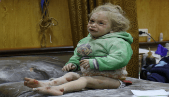طفلة سورية مصابة في إدلب