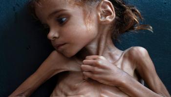 الطفلة اليمنية أمل حسين التي ماتت من الجوع (تويتر)
