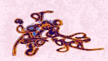 صورة مجهرية لفيروس إيبولا